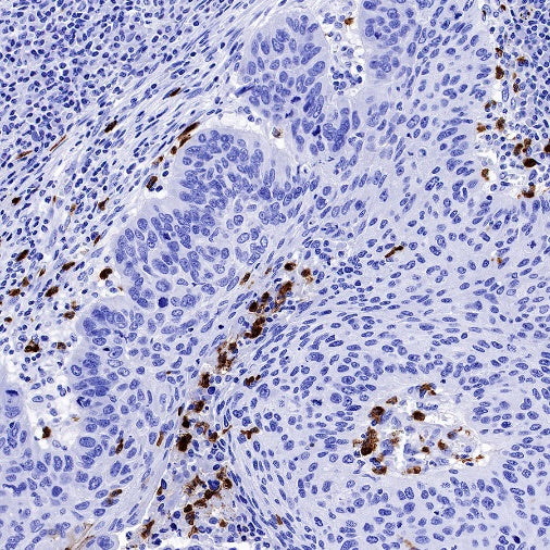 c-IAP1 Recombinant Rabbit mAb (S-1128-137)