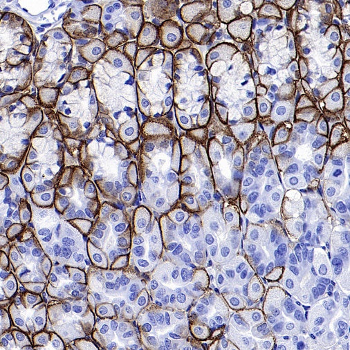AQP4 Recombinant Rabbit mAb (S-1609-62)