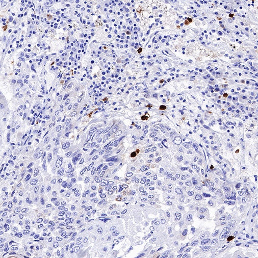 ALOX15 Recombinant Rabbit mAb (S-669-56)