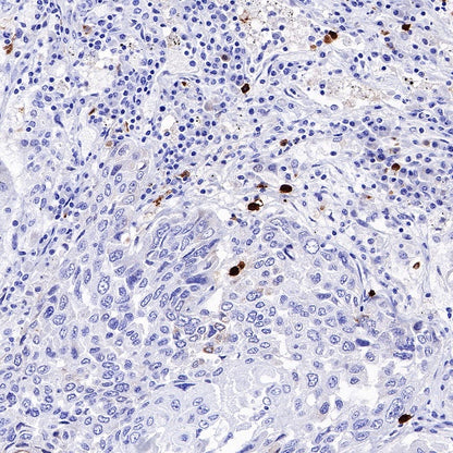 ALOX15 Recombinant Rabbit mAb (S-669-56)