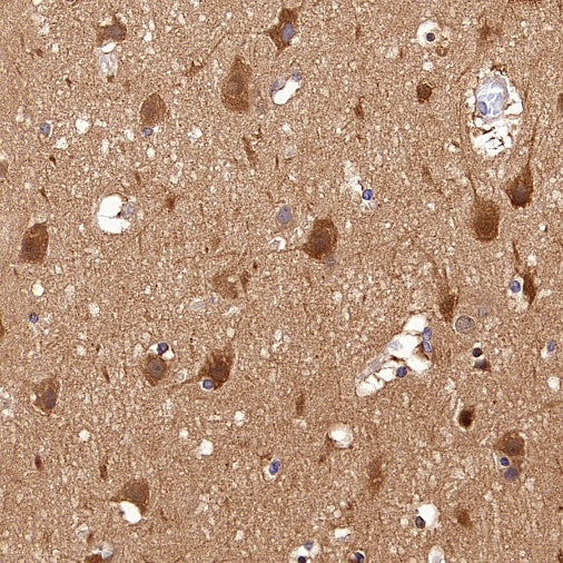 GPHN Recombinant Rabbit mAb (S-3167-63)