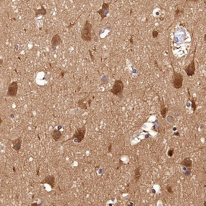 GPHN Recombinant Rabbit mAb (S-3167-63)