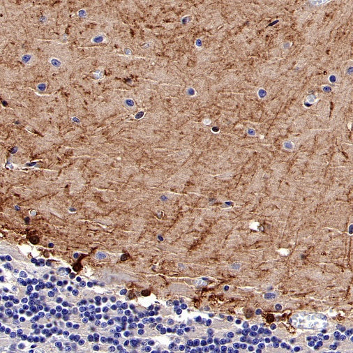 FABP7 Recombinant Rabbit mAb (S-762-41)