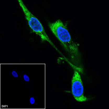 Vinculin Recombinant Rabbit mAb (FITC Conjugate) (S-1635-6)