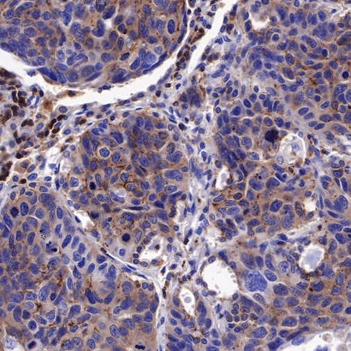 PI3 Kinase p85α Recombinant Rabbit mAb (S-328-24)