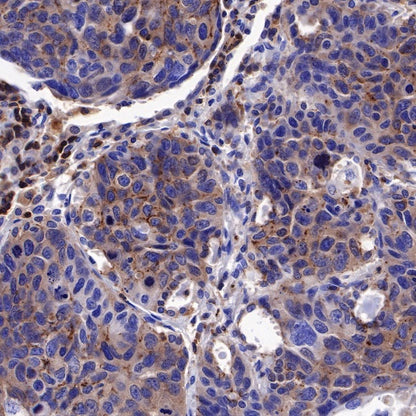PI3 Kinase p85α Recombinant Rabbit mAb (S-328-24)