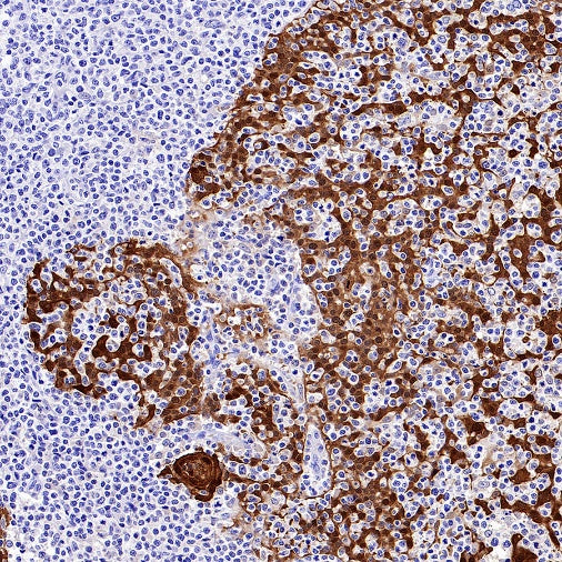 14-3-3 sigma Recombinant Rabbit mAb (S-2017-59)