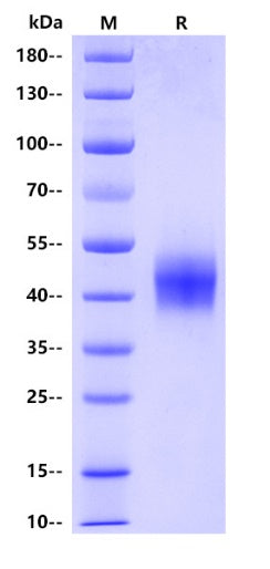 Mouse NCR1 Protein, His tag