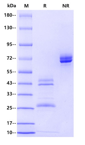 IL-12/IL-12A&IL-12B His Tag&No Tag Protein, Mouse