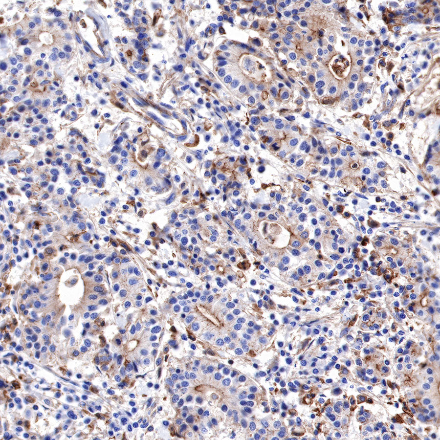 α-Actinin-1 Recombinant Rabbit mAb (SDT-311-20)