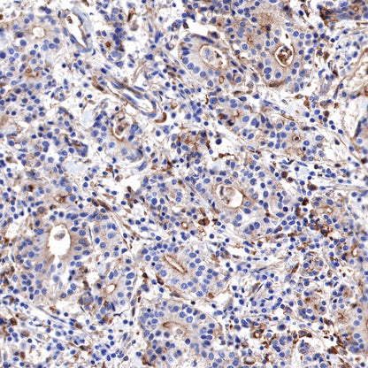 α-Actinin-1 Recombinant Rabbit mAb (SDT-311-20)