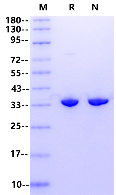 Pyrophosphatase, Inorganic