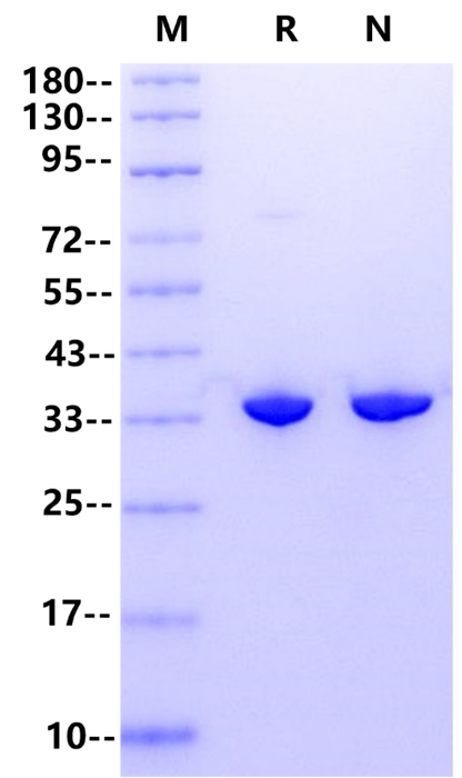 Pyrophosphatase, Inorganic