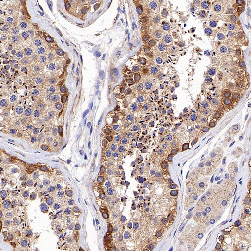 PI3 Kinase p85 beta Recombinant Rabbit mAb (S-1058-266)