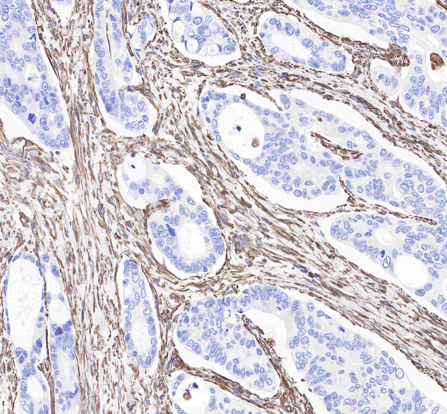Vimentin Recombinant Rabbit mAb,PBS Only (SDT-029-20)