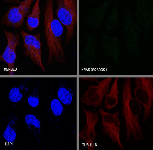 KRAS (mutated GQ60GK) + (mutated Q61K) Recombinant Rabbit mAb (S-604-4)