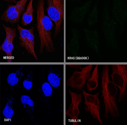 KRAS (mutated GQ60GK) + (mutated Q61K) Recombinant Rabbit mAb (S-604-4)