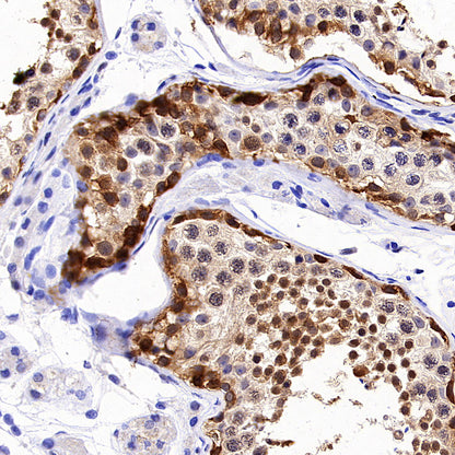 Tug Recombinant Rabbit mAb (S-4377-21)