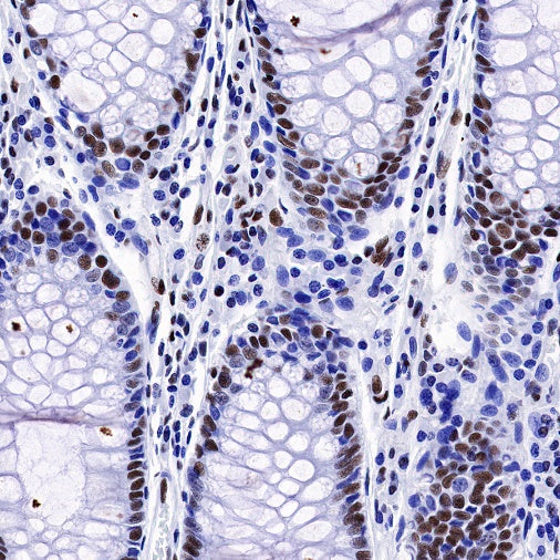 CREB Recombinant Rabbit mAb (S-1115-39)