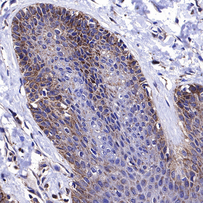 BAX Recombinant Rabbit mAb (SDT-338-76)