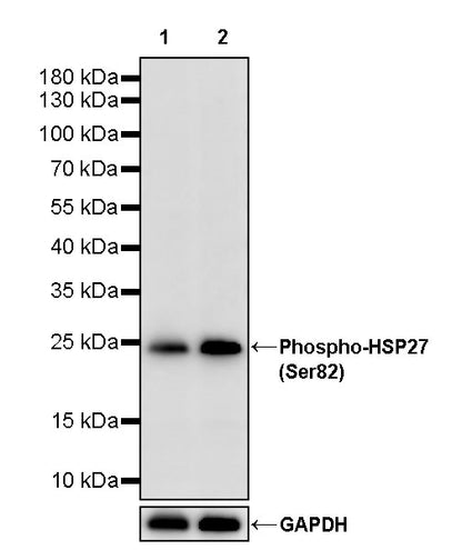 Phospho-HSP27 (Ser82) Recombinant Rabbit mAb (S-4792)