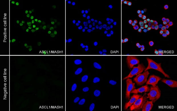 ASCL1/MASH1 Recombinant Rabbit mAb (SDT-3517-121)