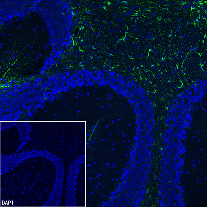 GFAP Recombinant Rabbit mAb (Alexa Fluor® 488 Conjugate) (SDT-306-10)