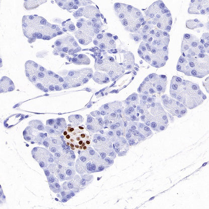 INSM1 Recombinant Rabbit mAb,PBS Only (SDT-3165-72)