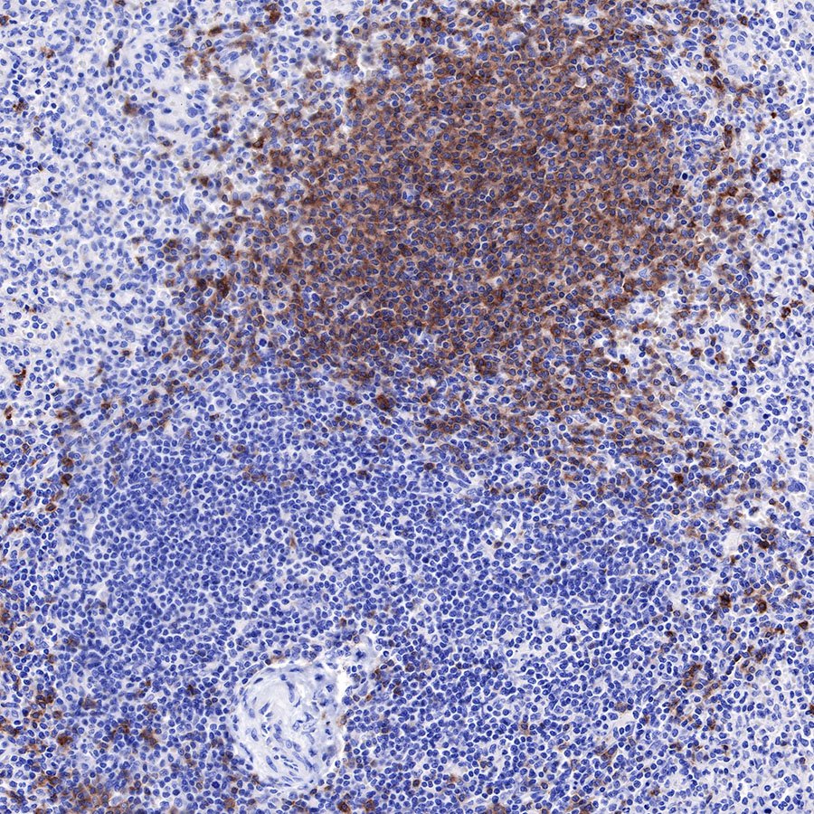 CD22 Recombinant Rabbit mAb (SDT-R113)