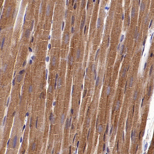 Hexokinase II Rabbit Polyclonal Antibody