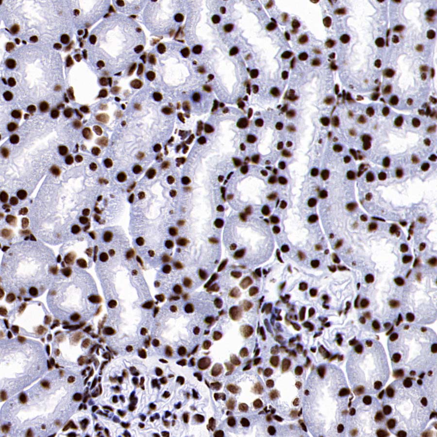 DDX39B Recombinant Rabbit mAb (S-4549-30)