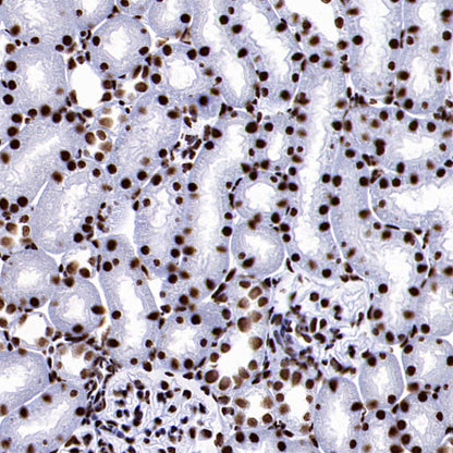 DDX39B Recombinant Rabbit mAb (S-4549-30)