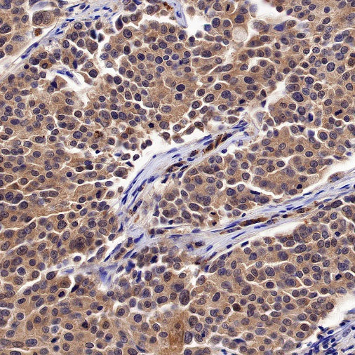Peroxiredoxin 3 Rabbit Polyclonal Antibody