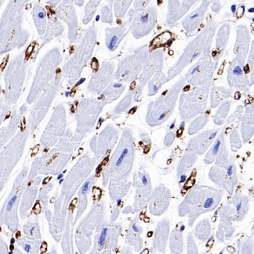 FABP4 Recombinant Rabbit mAb (S-1360-58）