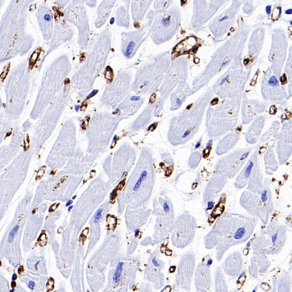 FABP4 Recombinant Rabbit mAb (S-1360-58）
