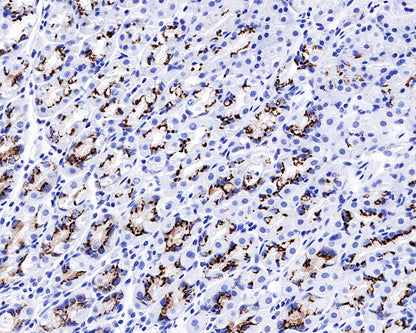 GP73/GOLPH2 Recombinant Rabbit mAb (SDT-231-102)