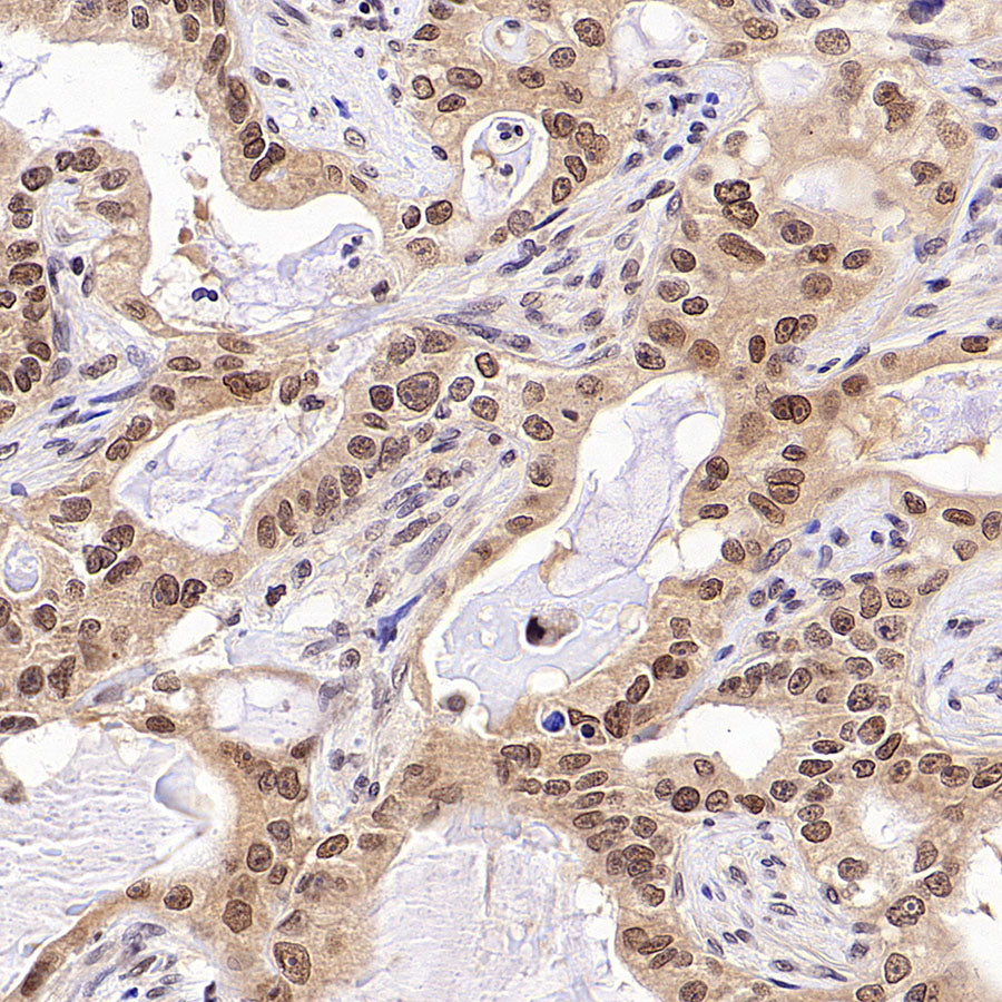 USP5 Rabbit Polyclonal Antibody