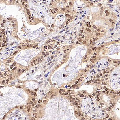USP5 Rabbit Polyclonal Antibody