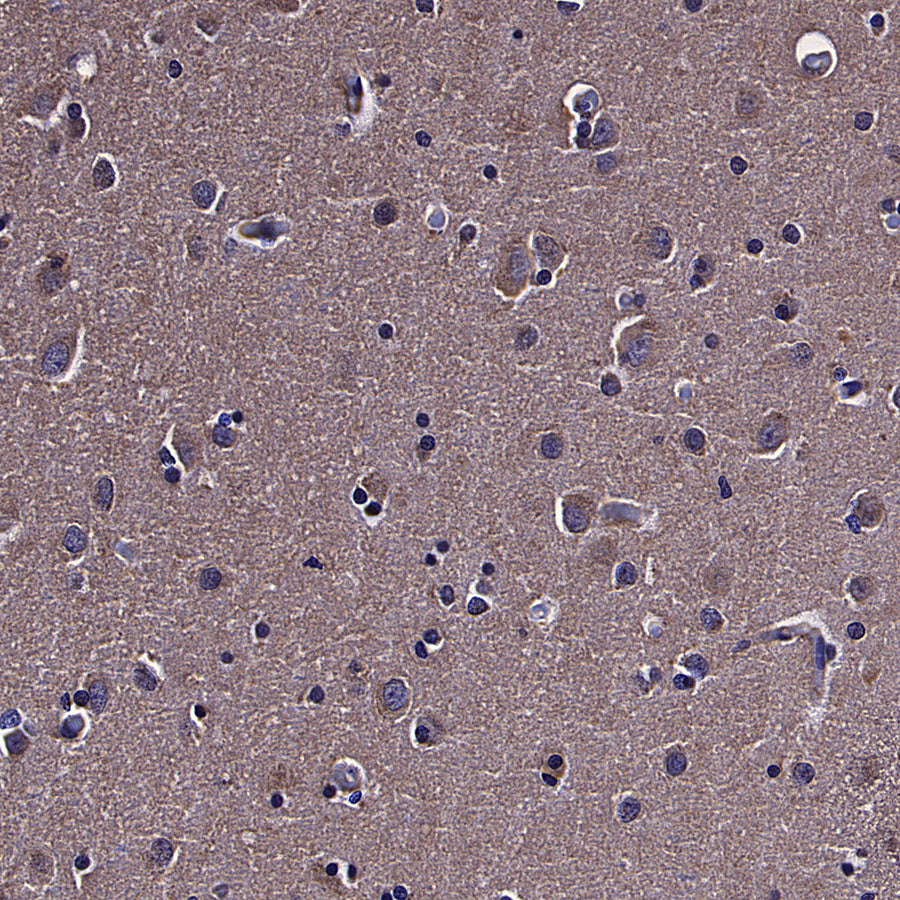 TOM70 Mouse mAb