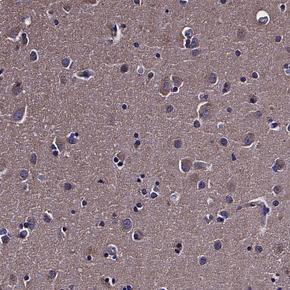 TOM70 Mouse mAb