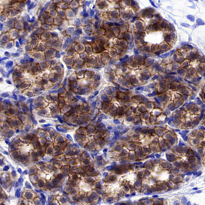 HER2/ErbB2 Recombinant Rabbit mAb (S-3935-58)