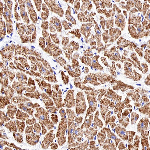 HADHA Recombinant Rabbit mAb (S-2345-8)