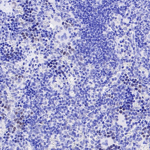 Phospho-Rb (Ser807/811) Recombinant Rabbit mAb (S-2215-52)