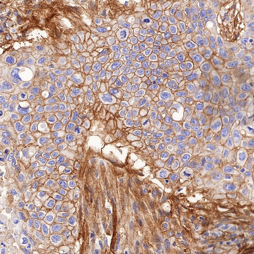 B7-H3 Recombinant Rabbit mAb (SDT-249-26)