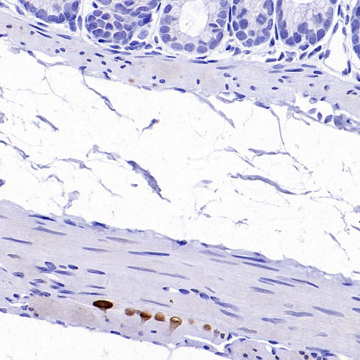 PHOX2B Recombinant Rabbit mAb (SDT-1142-21)