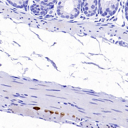 PHOX2B Recombinant Rabbit mAb (SDT-1142-21)