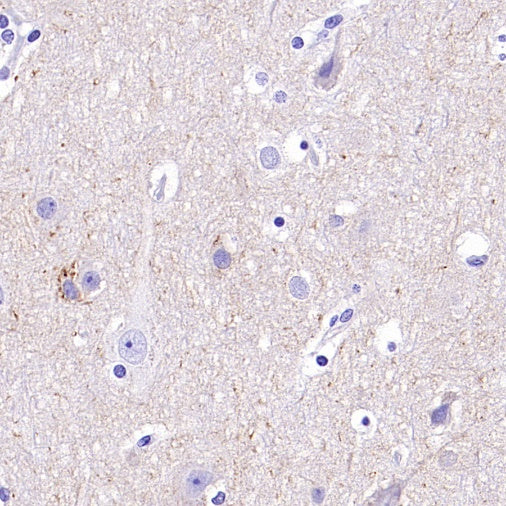 KCC2 Recombinant Rabbit mAb (S-3044-2)