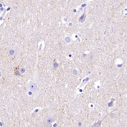 KCC2 Recombinant Rabbit mAb (S-3044-2)