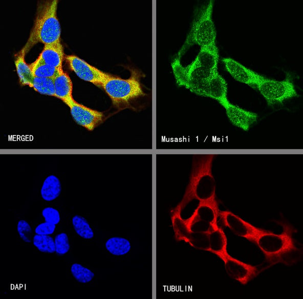 Musashi 1/Msi1 Recombinant Rabbit mAb (S-1477-58)