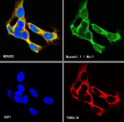 Musashi 1/Msi1 Recombinant Rabbit mAb (S-1477-58)